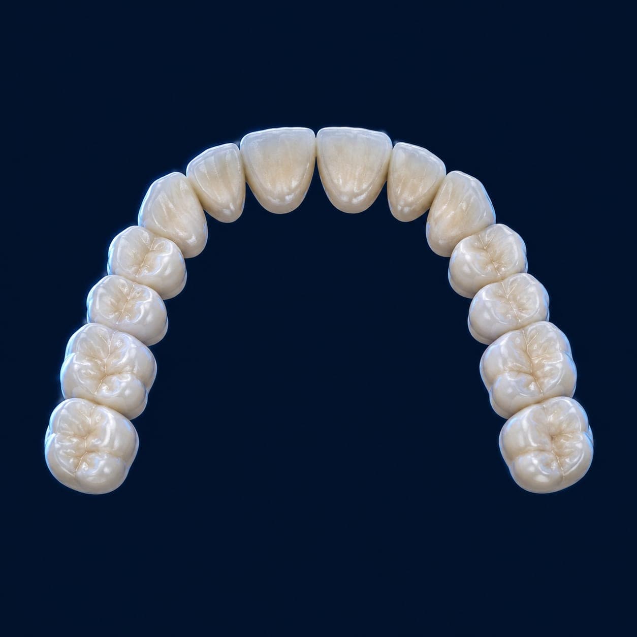 A 3D model of an upper dental arch with four gold treatment markers