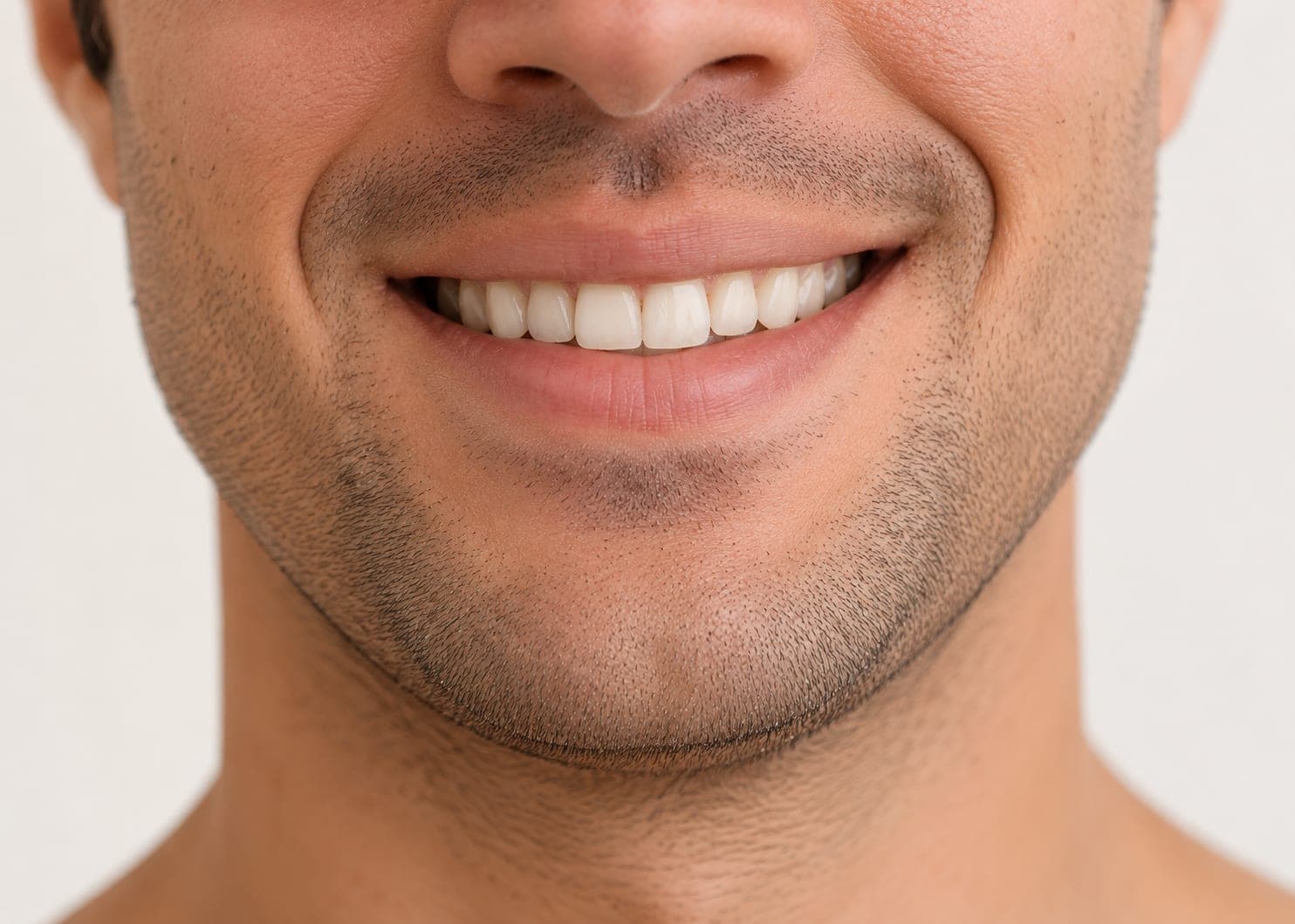 A missing upper premolar — After
