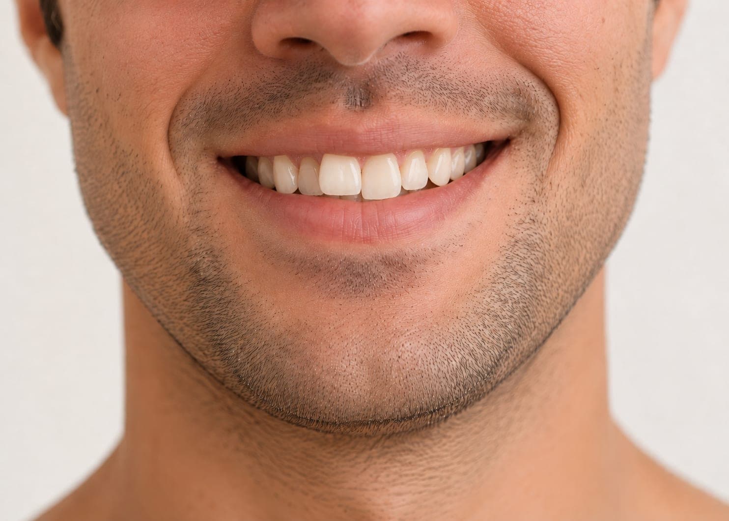 A missing upper premolar — Before
