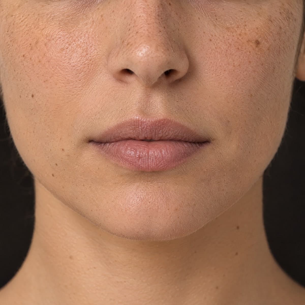 Lips and chin in close-up before a filler.